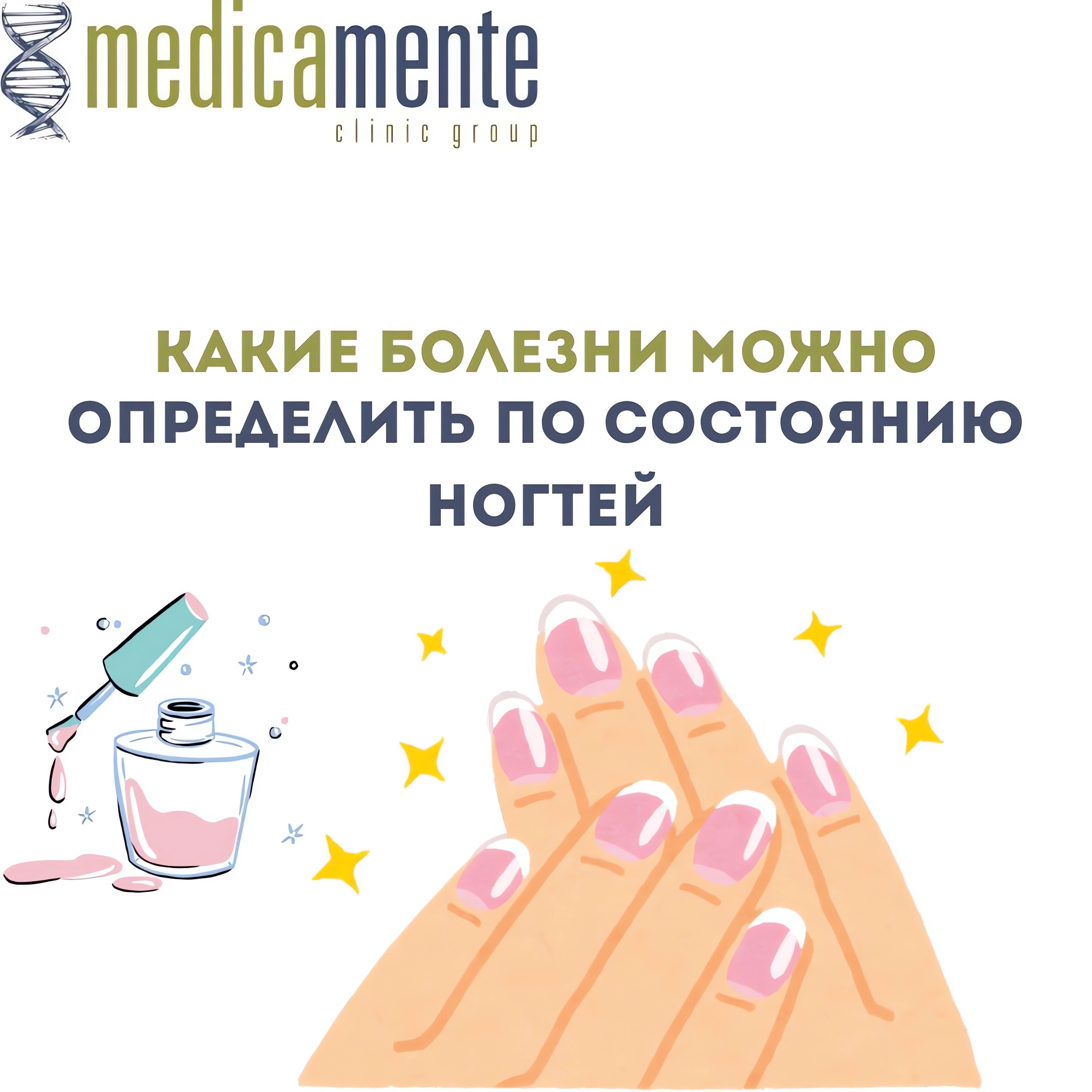 Какие болезни можно определить по состоянию ногтей